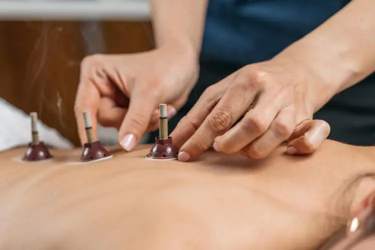 moxibustion-therapy-alternative-medicine.jpg