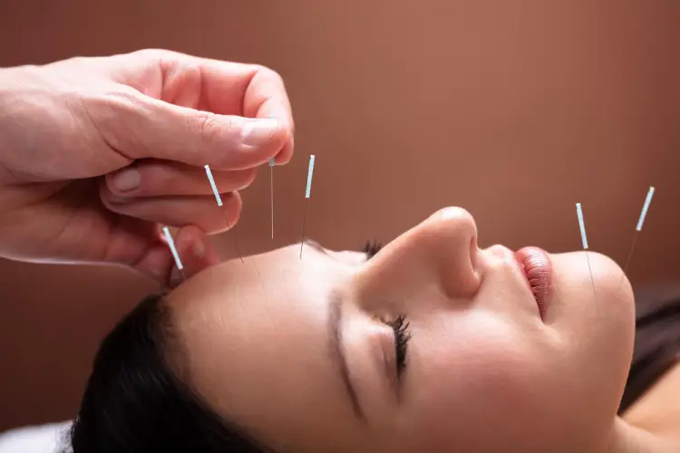 facial-acupuncture-cosmetic-treatment.jpg