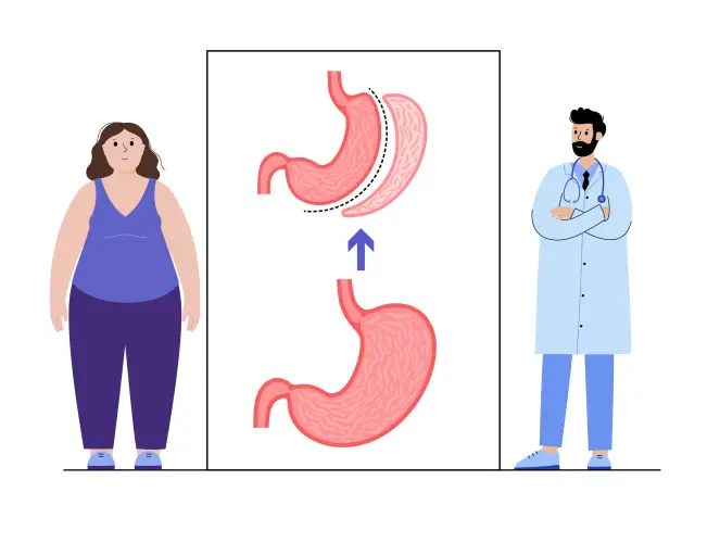 graphic-gastrectomy.jpg